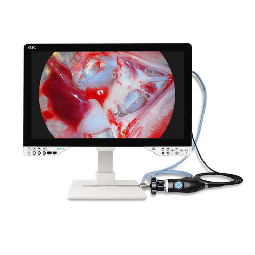 Endoskop-Kamera - TU-27LSD1A - Shenzhen Tuyou Medical Imaging Co., Ltd.​ - medizinisch / digital / hochauflösend