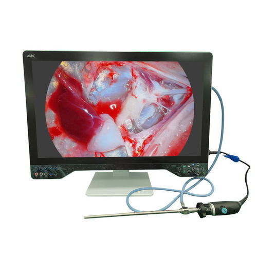 Endoskop-Kamera - TU-32LSD1A - Shenzhen Tuyou Medical Imaging Co., Ltd.​ - medizinisch / OP / digital