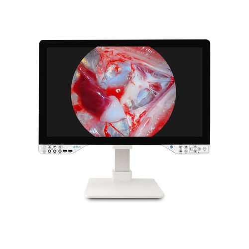 Endoskop-Kamera - TU-27LSD2B - Shenzhen Tuyou Medical Imaging Co., Ltd.​ - digital / VGA / hochauflösend