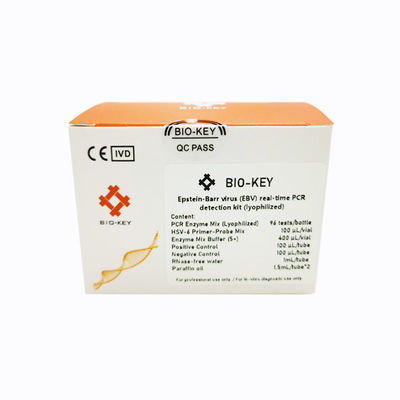 Testkit für Infektionskrankheiten - BIK-QL-H0017 - Biokey Health - Epstein-Barr-Virus / Serum / Plasma