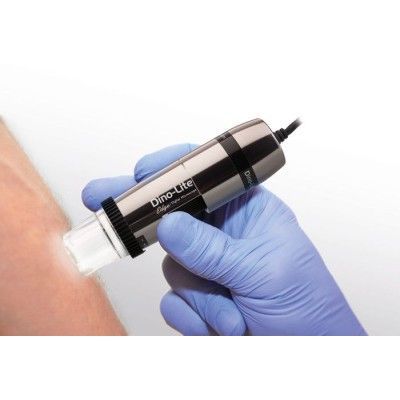 Videodermatoskop - Dino-lite - Comitas e- Health - weiße LED