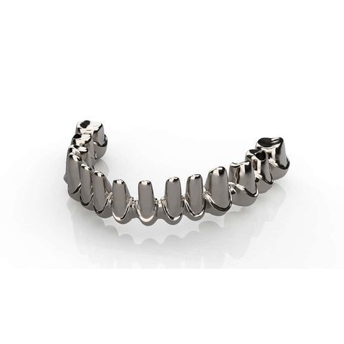 Metall-Zahnbrücke - Kangli Medical - für Vorderzähne