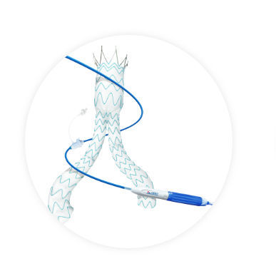 Stentgraft / Arteria iliaca - Minos™ - Endovastec - Aorta abdominalis / Nitinol / Polyethylen