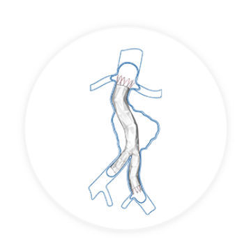 Stentgraft / Aorta abdominalis - Aegis™ - Endovastec - Nitinol / ePTFE