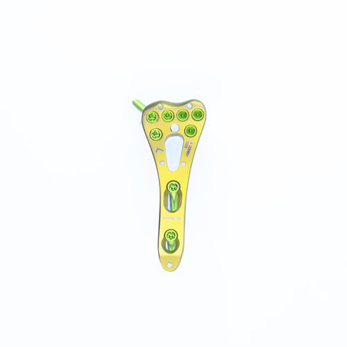 Kompressionsplatte für Radius - SDP-69 - Chongqing FWS Medical Devices - distal / mit Verriegelung / Titan