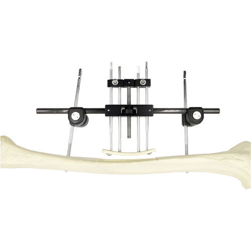 Fixateur externe / für Oberschenkelknochen - Chongqing FWS Medical Device - rohrförmig / für Erwachsene