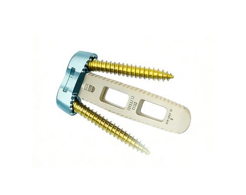 HWS-Zwischenwirbelimplantat - O-LIF - Chongqing FWS Medical Device - ventraler Zugang / aus PEEK
