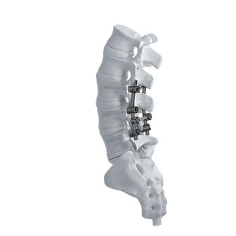 Stabilisierungssystem für Osteosynthese / LWS - CTS 5.5 - Mediox - dorsaler Zugang / für Erwachsene