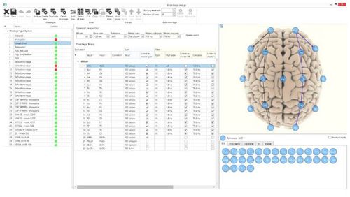 EEG-Software - BRAIN QUICK® - Natus Micromed - für Krankenhaus / Patientendaten / für Intensivpflege