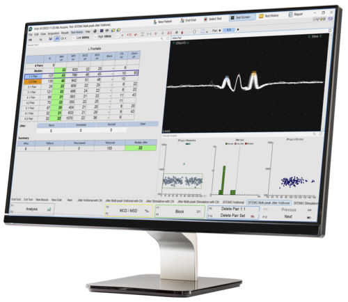 Software für EMG - Natus Elite&reg; - Natus Micromed - Analyse / Diagnose / Bewertung