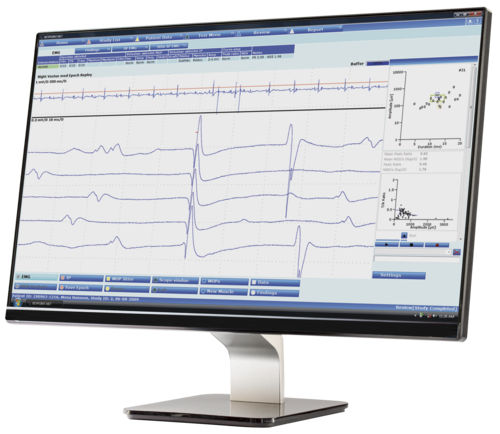 Software für EMG - Keypoint.NET - Natus Micromed - Diagnose / Interpretation / für Neurokonduktivität