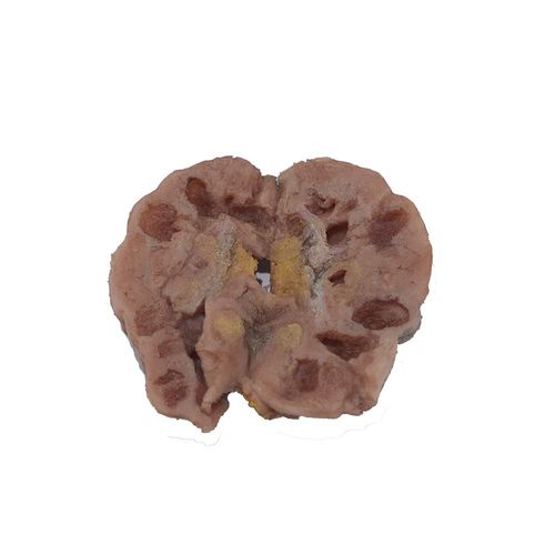 Anatomisches Modell / Niere - PM-001 - MeiWo Science - für die Gesundheitserziehung / für die Ausbildung / für Krebserkrankungen