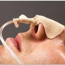 Katheterfixierung für nasogastrale Sonde - Difanas - Zadi Tıbbi Gereçler San. ve Tic. A.Ş. - Schädel / klebbar