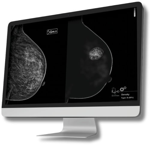 Computerprogramm für Mammographie-Tomosynthese - Hera-MI