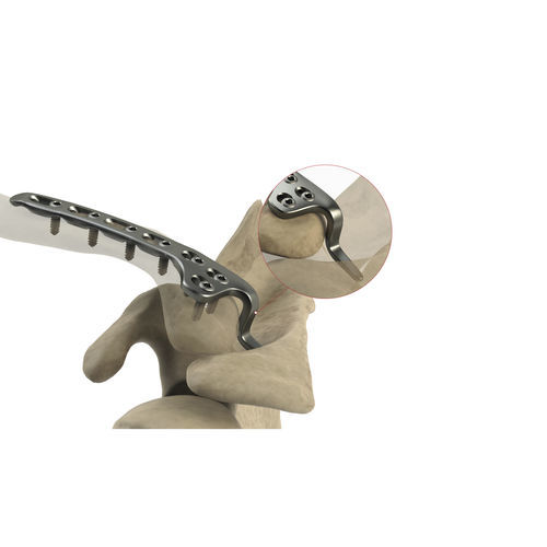 Kompressionsplatte für Schlüsselbein - AS.SH.031 - Ases Orthopedics - distal / mit Verriegelung / ohne Verriegelung