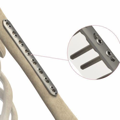 Kompressionsplatte für Radius - AS.ST.068 - Ases Orthopedics - medial / mit Verriegelung / ohne Verriegelung