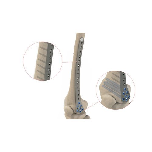 Kompressionsplatte für Femurkondylus - Ases Orthopedics - distal / mit Verriegelung
