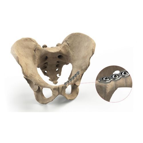 Kompressionsplatte für Becken - Ases Orthopedics - mit Verriegelung