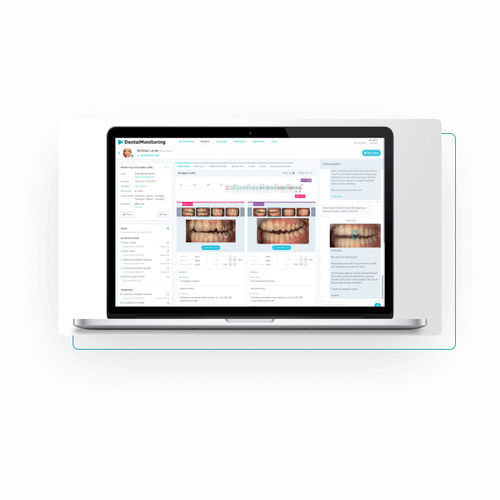 KI-Plattform / Dental - Dental Monitoring - Bildanalyse / Umform / Erfassung