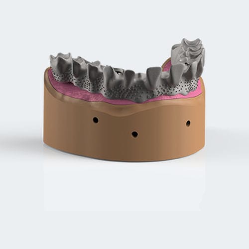 Titan-Zahnprothese - DUO LINE - NEW ANCORVIS S.r.l - CoCr / für Vorderzähne / abnehmbar