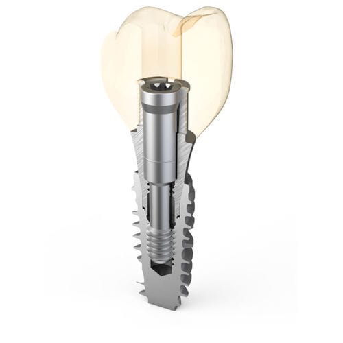 Implantat-Abutment / Titan - Master Fix - ARUM DENTISTRY Co., Ltd. - mit Außenverbindung / gewinkelt / Schrauben