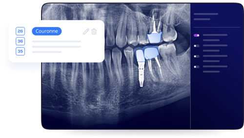 Software für Dentalimplantologie - Allisone - Allisone Technologies - für Zahnchirurgie / Röntgen / Visualisierung
