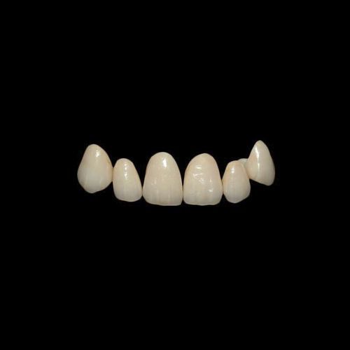 Zirkonoxid-Zahnkrone - Shenzhen Alcadent Co.Ltd Alcadent Dental Laboratory - oberer Schneidezahn / für Seitenzähne