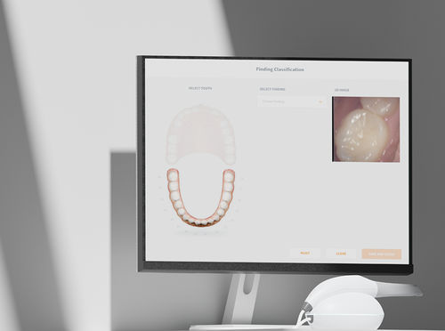 Umform-Software - Scan&Tell - 3DISC DENTAL CONNECT - Erfassung / medizinisch / Dental
