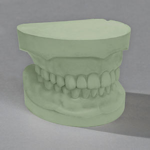 Zahnmedizinisches Material / Stein - Glastone® 3000 die - Ransom & Randolph - für Zahnbrücken / für Dentalkronen