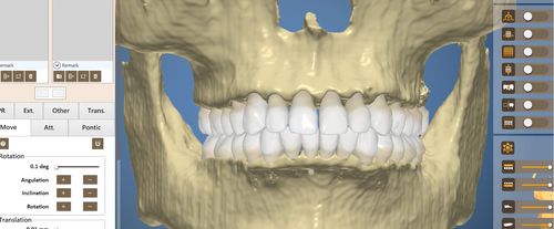 Dental-Software - OrthoAnalysis - Inteware Co., Ltd - Analyse / Umform / Behandlungsplanung