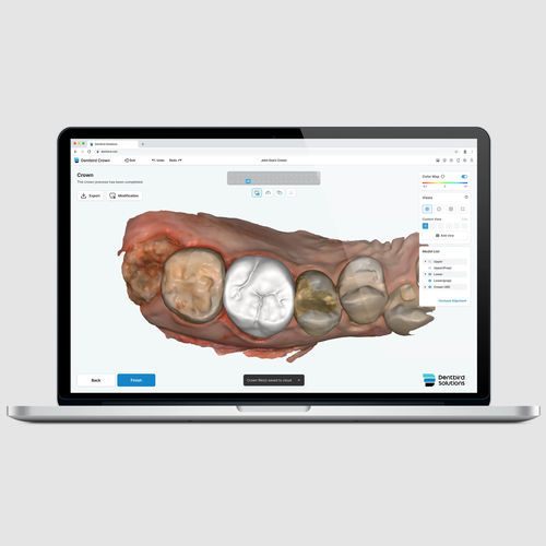 Projektentwicklungssoftware - Dentbird Crown - Imagoworks Inc. - CAD / Erfassung / Druck