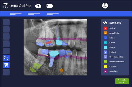 Medizinische Software - dentalXrai Pro 3.0 - dentalXrai GmbH - Dental / parodontal / für Radiologie