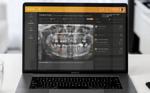 KI-Plattform / für medizinische Bildgebung - Second Dentist ™ - VELMENI - medizinisch / Dental / Analyse