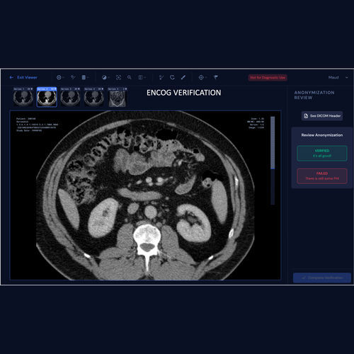 Web-Anwendung / Datenverwaltung - ENCOG™ - Enlitic - zur Nachvollziehbarkeit der Daten / medizinisch / Computertomographie