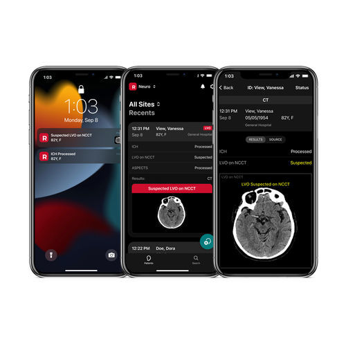 Mobile Applikation / für Schlaganfalldiagnostik - NCCT - RapidAI - medizinisch / Computertomographie / Bildanalyse