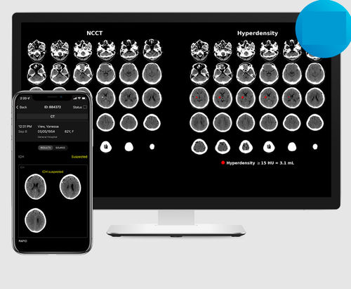 Diagnose-Software - ICH - RapidAI - mit künstlicher Intelligenz / medizinisch / für Kliniken