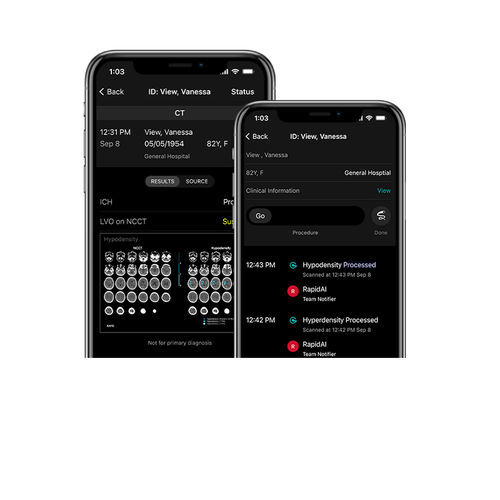Mobile Applikation / Umform - RapidAI - Content-Sharing / für Schlaganfalldiagnostik / medizinisch