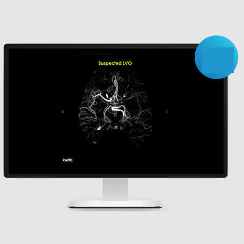 Software für Schlaganfalldiagnostik - LVO - RapidAI - Bestätigung / KI-gestützt / medizinisch