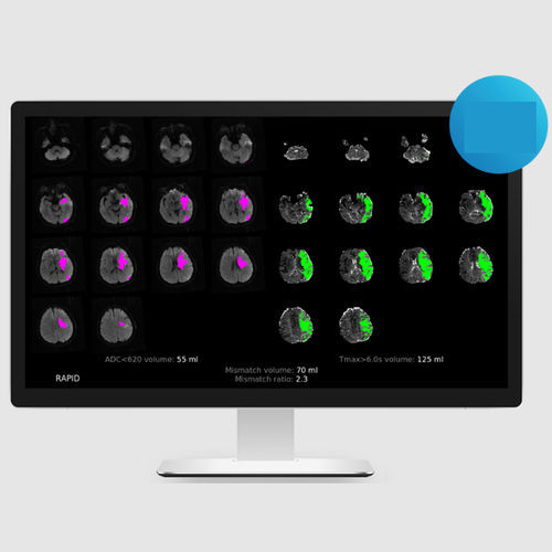 Medizinische Software - MRI - RapidAI - für Kliniken / Bildanalyse / Erfassung