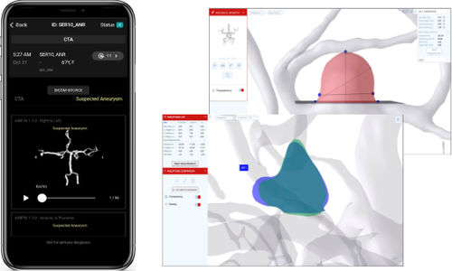 Medizinische mobile Applikation - RapidAI - für Neurochirurgie / Management / Umform