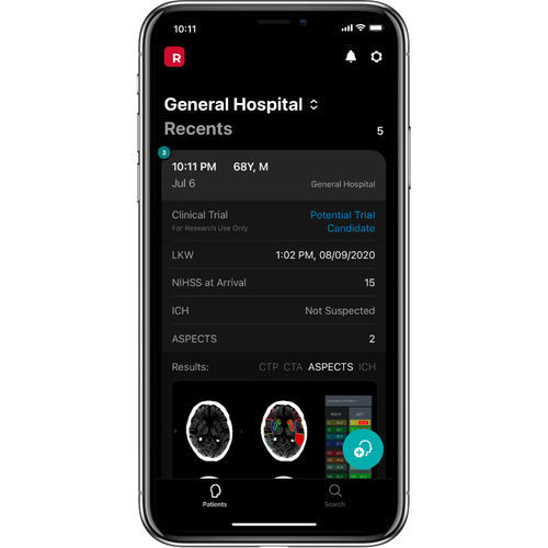 Medizinische mobile Applikation - RapidAI - Verwaltung für klinische Studien / Echtzeit / KI-gestützt