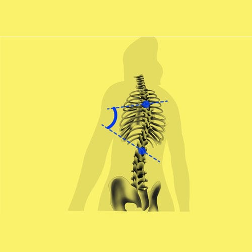 Interpretations-Software - BoneMetrics - Gleamer - Standardisierung / medizinisch / für Kliniken