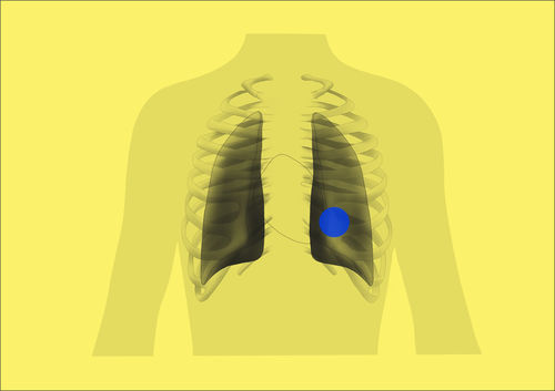 Projektentwicklungssoftware - ChestView - Gleamer - Erfassung / medizinisch / Computertomographie
