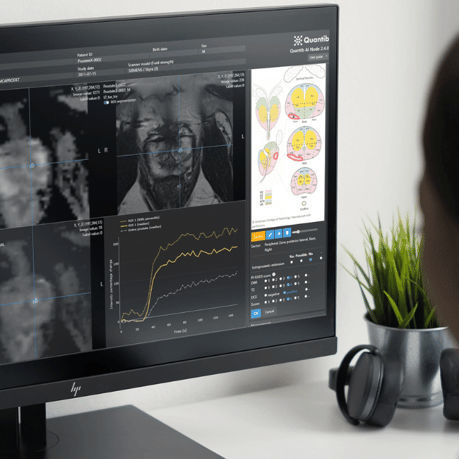 Software für Radiologie - QUANTIB® - Quantib B.V. - Bildanalyse / Bewertung / Ultraschall