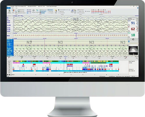 Analysesoftware - Polysmith  - Neurotronics - Management / Reporting / Viewer
