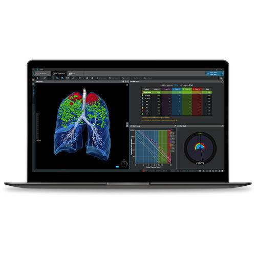 Medizinische Software - COPD - Coreline - für Kliniken / für Forschungszwecke / Analyse