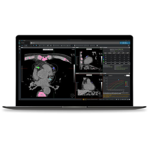 Analysesoftware - CAC - Coreline - Reporting / medizinisch / Computertomographie