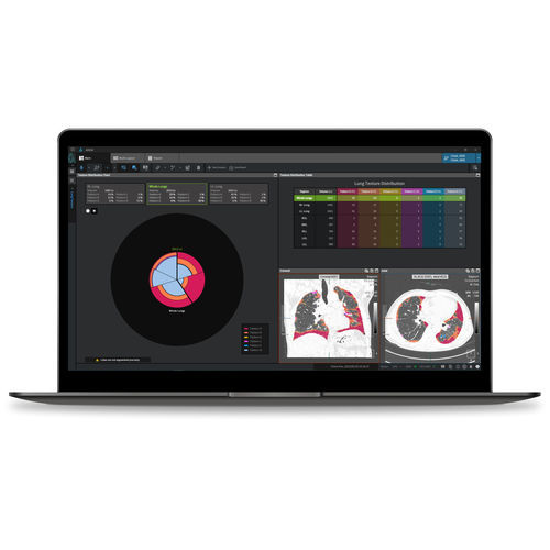Analysesoftware - Coreline - Reporting / Interpretation / medizinisch