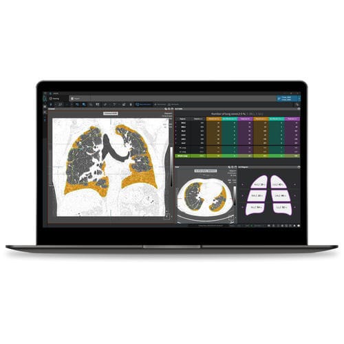 Analysesoftware - ILA - Coreline - Reporting / medizinisch / Lungen