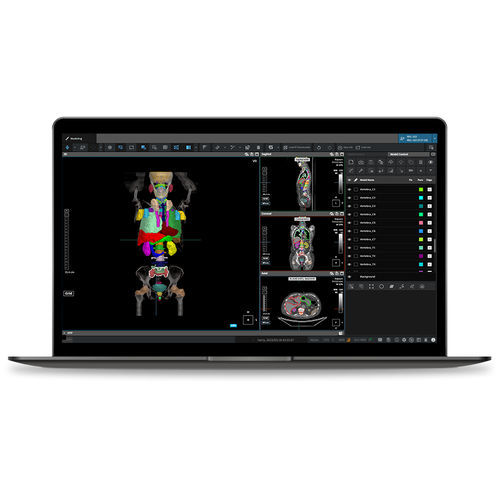 Medizinische Software - RT ACS - Coreline - für Strahlentherapie / Behandlungsplanung / Umform